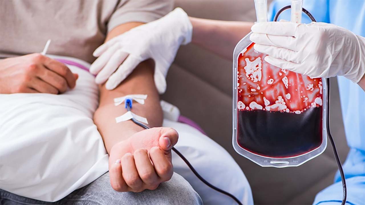 Tidak Ditularkan Tapi Diturunkan, Begini Tanda-tanda Orang Penderita Thalassemia