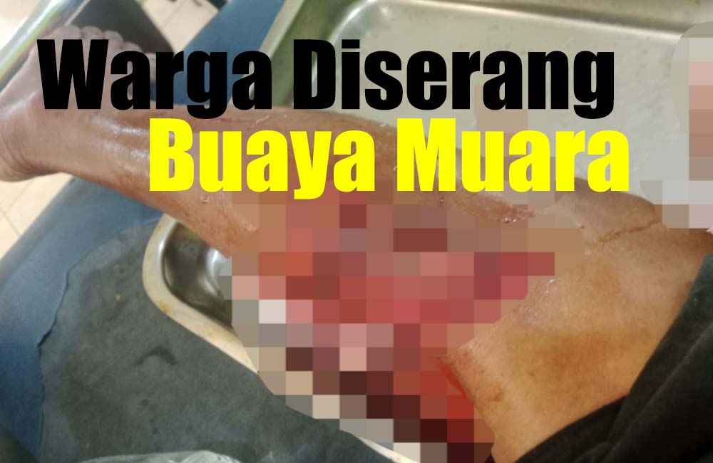 Warga Mukomuko Diduga Digigit Buaya di Muara Sungai Air Manjuto, Begini Kondisinya