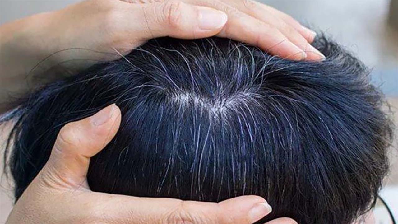 Ini Solusi Menghilangkan Uban di Apotek: Pilihan Minyak Rambut Berkualitas untuk Kembalikan Warna Rambut Alami