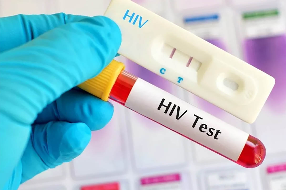 Inilah Jenis-Jenis Tes HIV Untuk Mendeteksi Seseorang Positif HIV atau Tidak