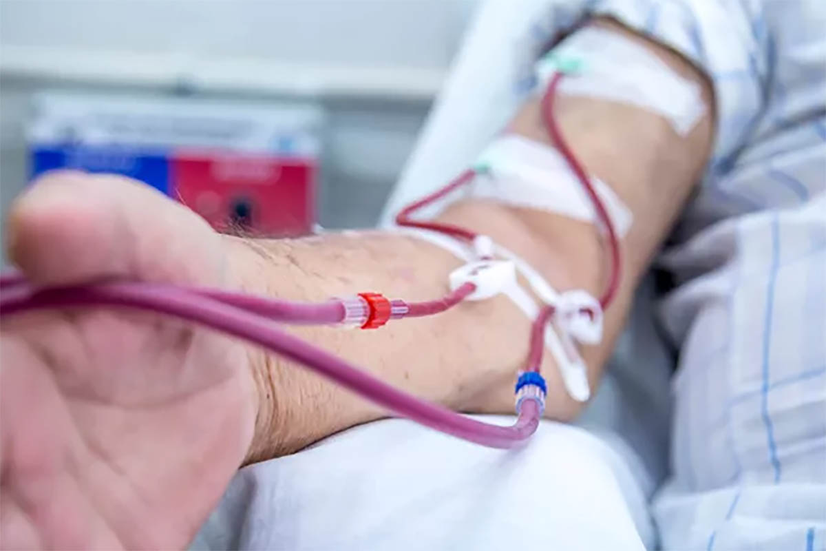 Inilah Besaran Biaya Cuci Darah Bagi Penderita Gagal Ginjal dan Efek Sampingnya