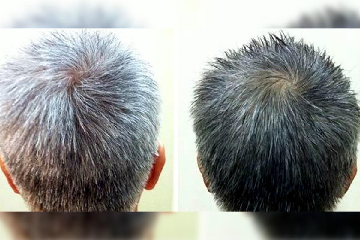 Atasi Uban Berlebihan Pada Rambut dengan Minyak Berikut, Harganya Murah dan Ada di Apotek