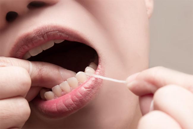 Yuk Kenali Istilah Flossing untuk Menjaga dan Merawat Kesehatan Gigi