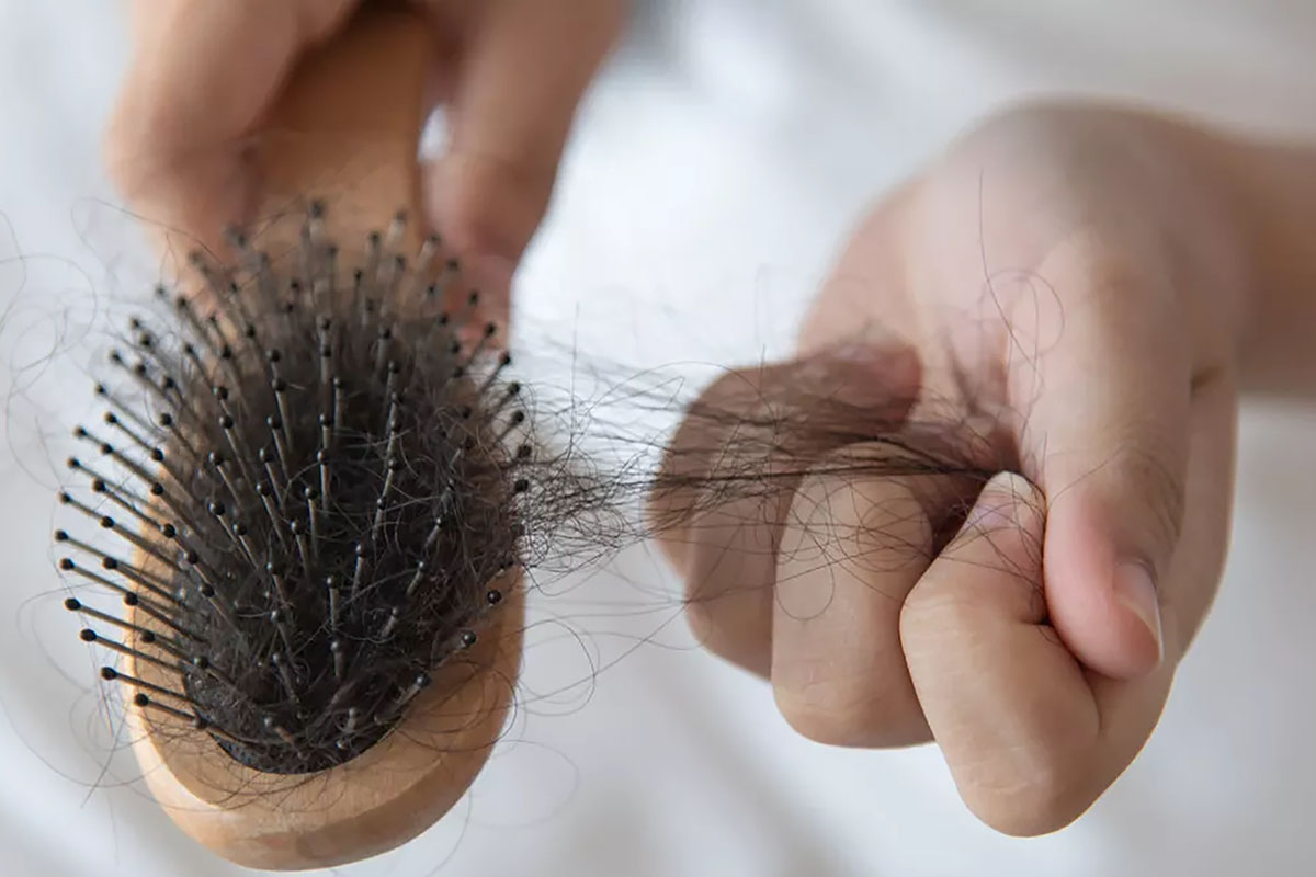 Punya Masalah Rambut Rontok yang Berlebihan? Begini Cara Mengatasinya