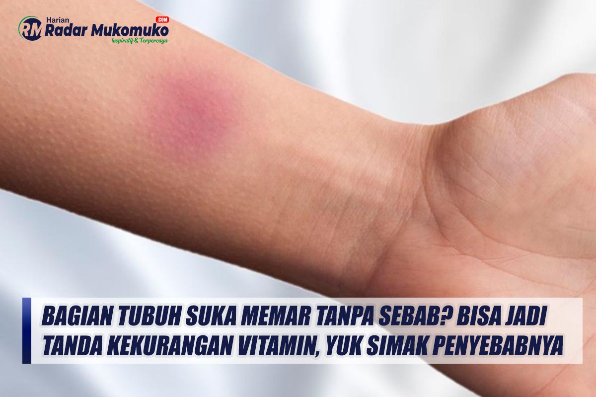 Bagian Tubuh Suka Memar Tanpa Sebab? Bisa Jadi Tanda Kekurangan Vitamin, Yuk Simak Penyebabnya