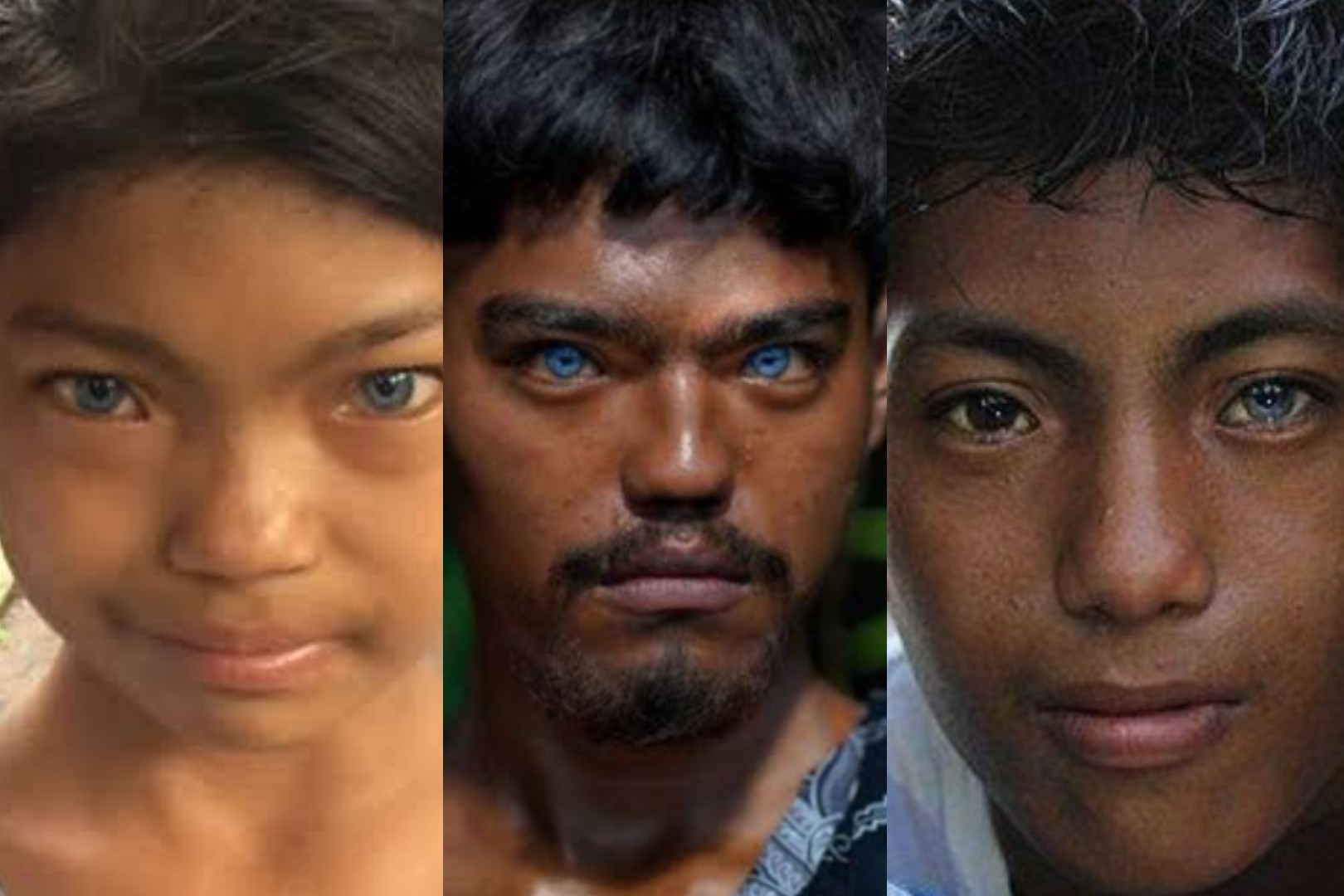 Alasan Tiga Suku Ini Bermata Biru, Sindrom Waardenburg dan Faktor Keturunan