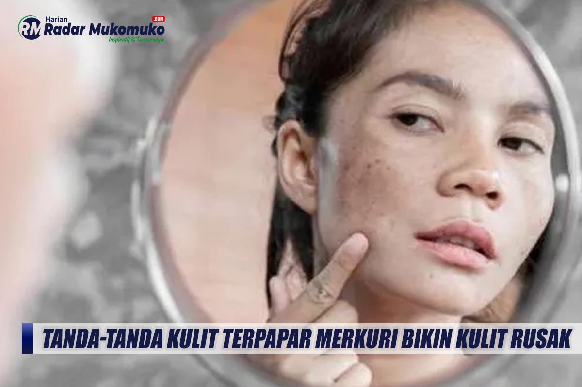 Jangan Sepelekan Tanda-tanda Ini, Inilah Tanda-tanda Kulit Terpapar Merkuri Bikin Kulit Rusak