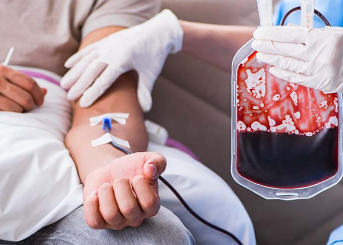 Tidak Ditularkan Tapi Diturunkan, Begini Tanda-tanda Orang Penderita Thalassemia