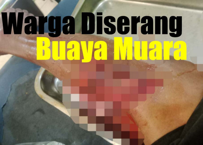 Warga Mukomuko Diduga Digigit Buaya di Muara Sungai Air Manjuto, Begini Kondisinya