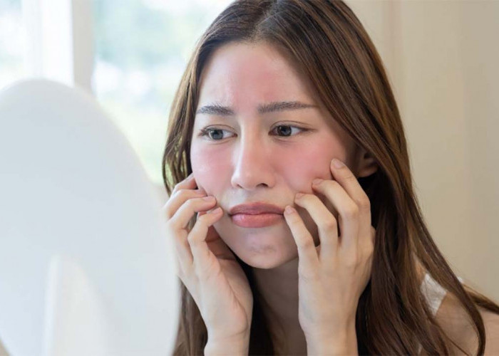 Skincare Tidak Cocok? Atasi dengan 5 Tips Jitu Ini dan Dapatkan Kulit Sehat Impianmu