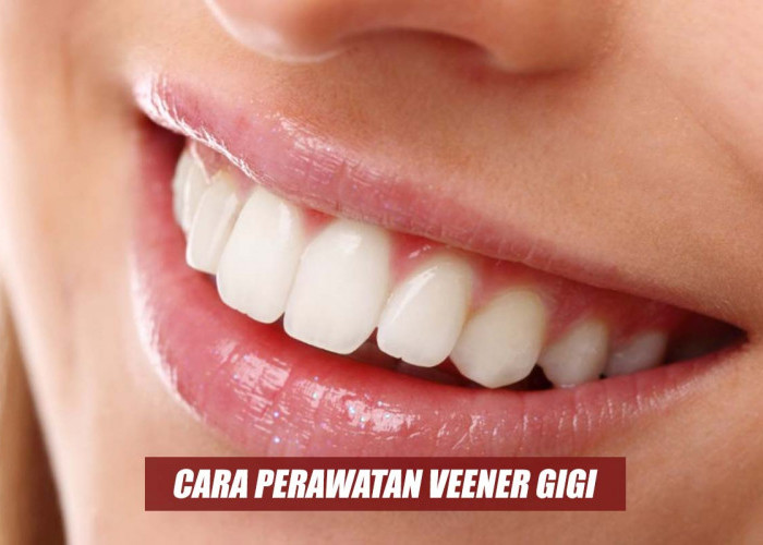 Bingung Melakukan Perawatan Veener Gigi? Simak Begini Cara Merawat Veener yang Tepat
