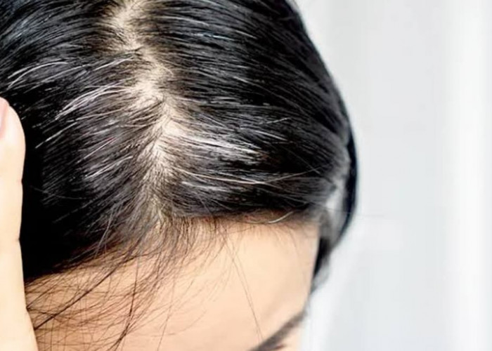 Rambut Mulai Beruban?? Coba 5 Tips dan Trik Menghilangkan Uban Secara Alami Tanpa Cat