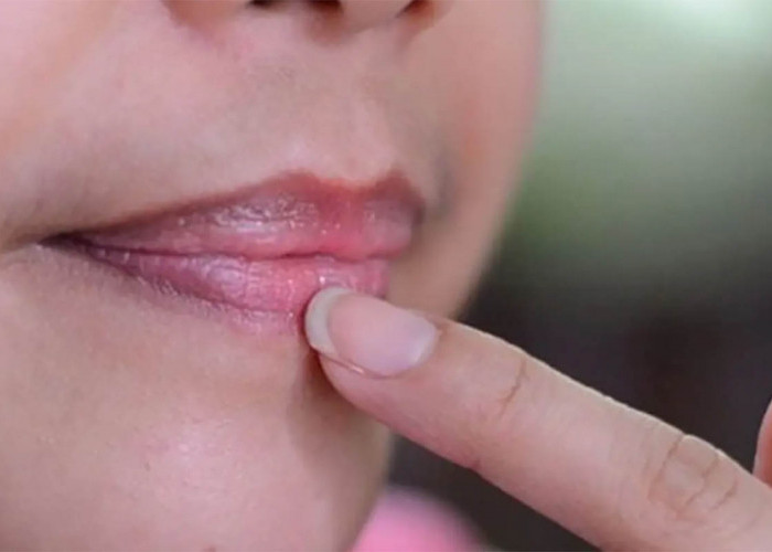 Mengapa Bibir Menjadi Hitam Padahal Tidak Merokok? Yuk Simak Ulasannya