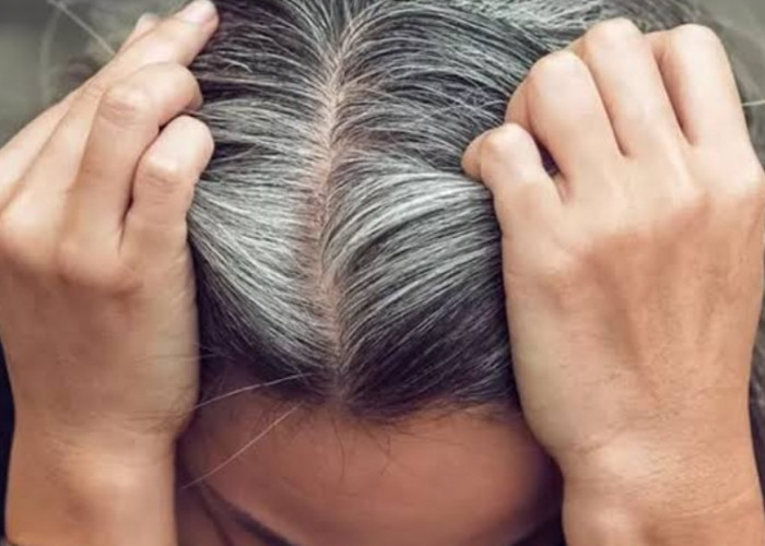 Rambut Beruban Bikin Tak Percaya Diri, Ini Cara Hilangkan Uban dengan Minyak Kayu Putih