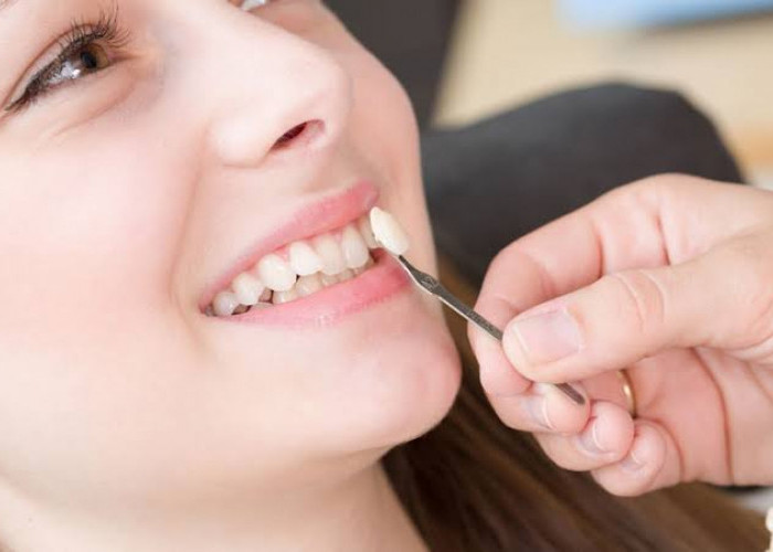 Ngga Perlu Pakai Behel, Berikut Adalah Cara Merapikan Gigi yang Berantakan