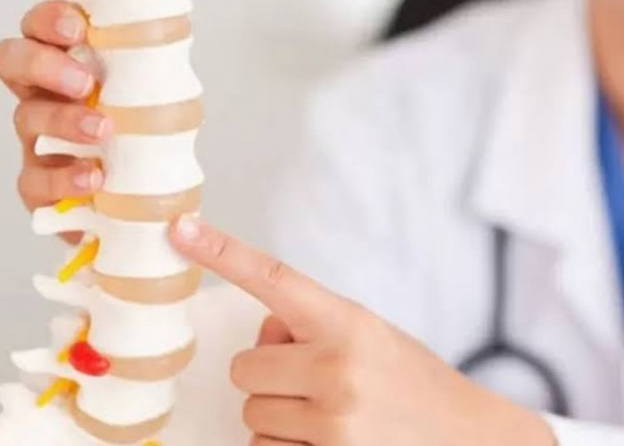 Kenali Tanda Osteoporosis Penyakit Keropos Tulang yang Bisa Dicegah dan Diobati