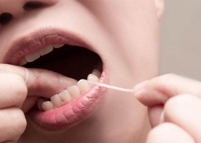 Yuk Kenali Istilah Flossing untuk Menjaga dan Merawat Kesehatan Gigi