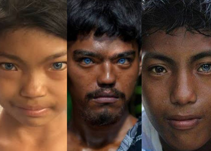 Alasan Tiga Suku Ini Bermata Biru, Sindrom Waardenburg dan Faktor Keturunan
