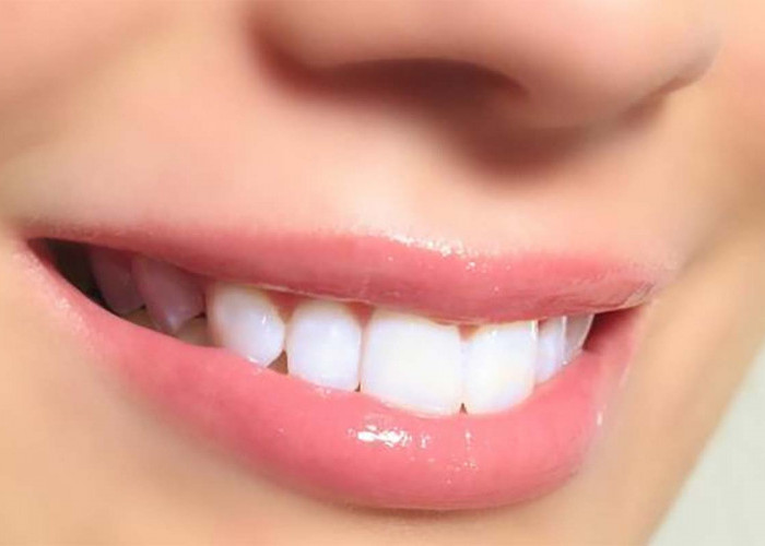 Pakai Satu Tanaman Ini Flek Gigi Hilang! Gigi Putih di Hari Raya Idul Fitri