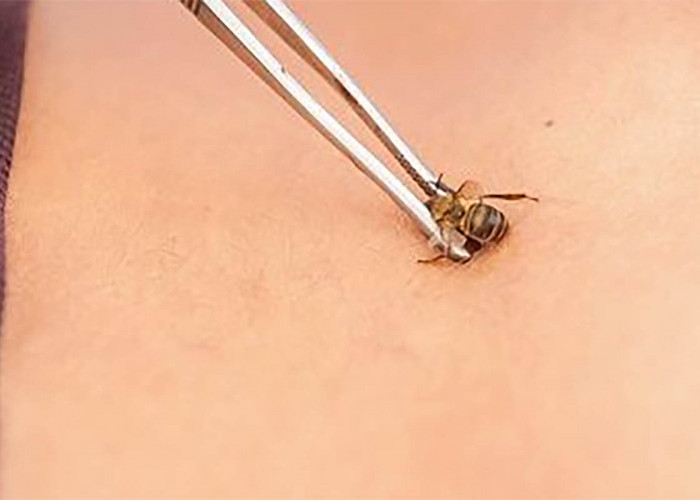Apakah Terapi Lebah Bisa Menyembuhkan Penyakit?